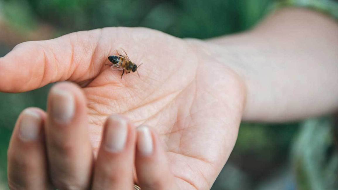 Tips for treating bites and stings this summer